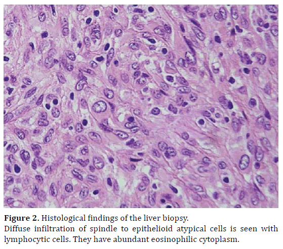 pancreas-histological-findings-liver