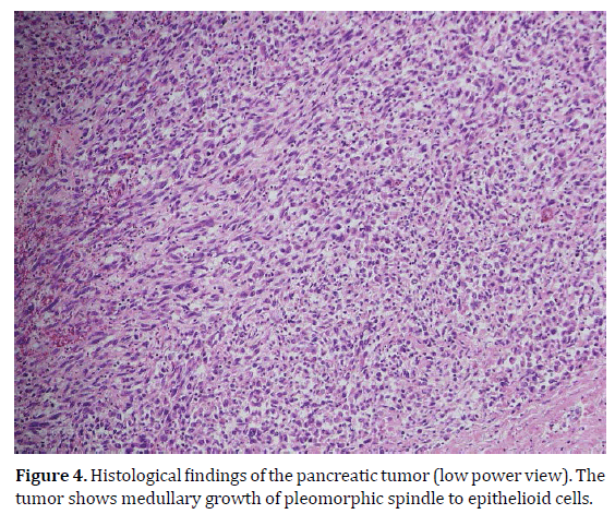 pancreas-histological-findings-low