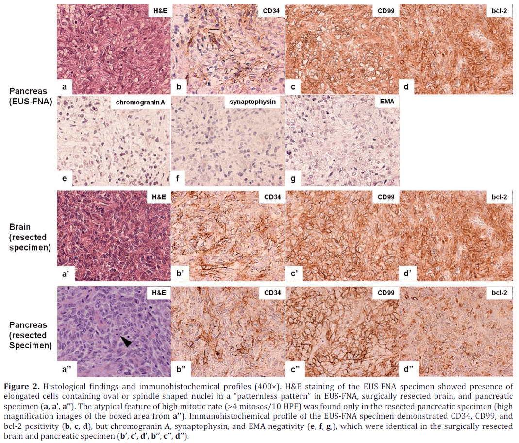 pancreas-histological-immunohistochemical