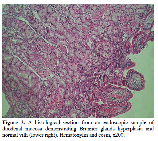 pancreas-histological-section-endoscopic