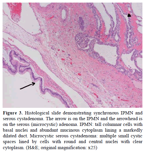 pancreas-histological-slide-demonstrating