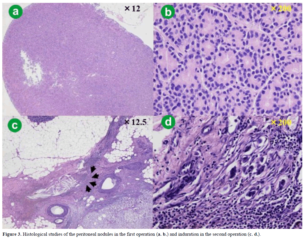 pancreas-histological-studies-peritoneal