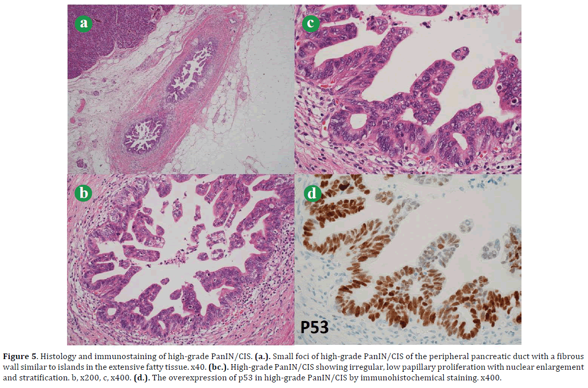 pancreas-histology-immunostaining-grade