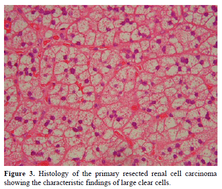 pancreas-histology-primary-resected