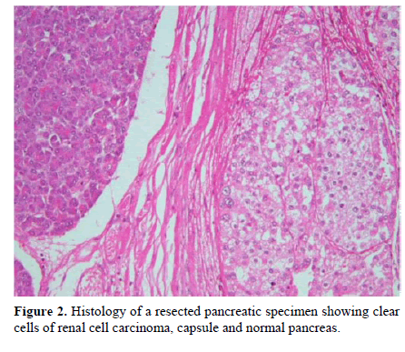 pancreas-histology-resected-pancreas