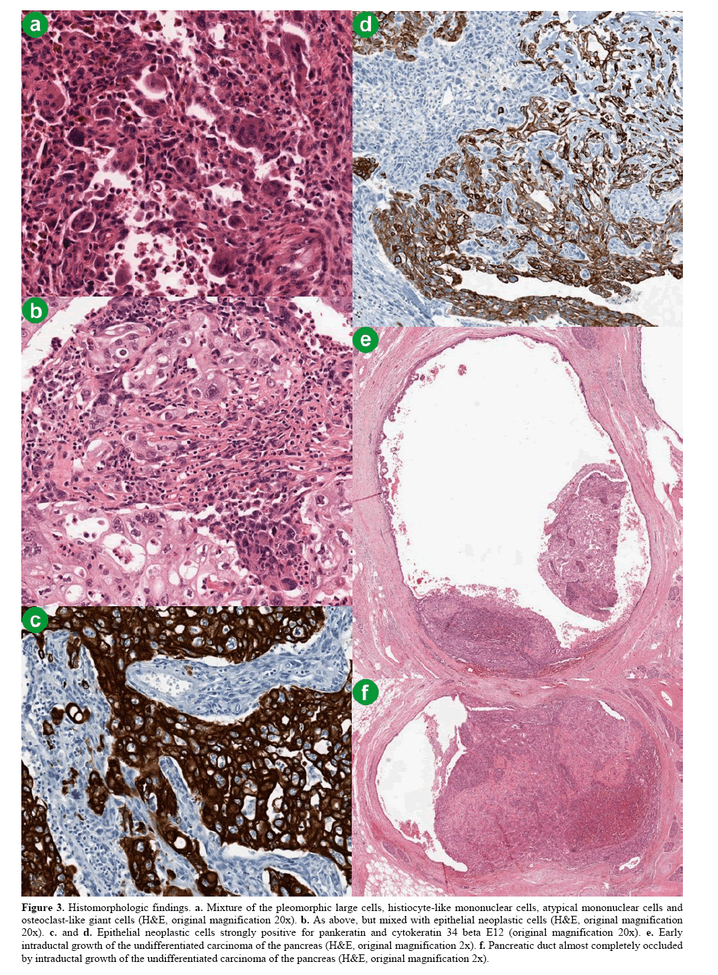 pancreas-histomorphologic-findings