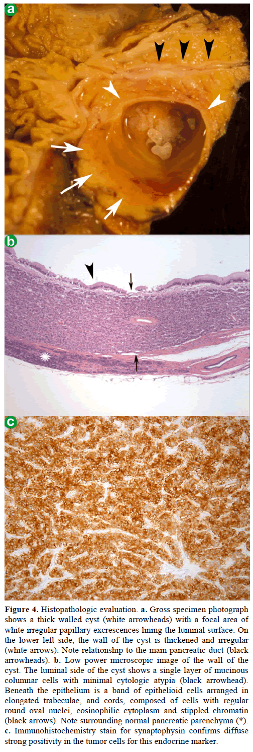 pancreas-histopathologic-evaluation