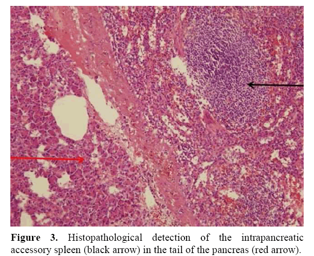 pancreas-histopathological-detection