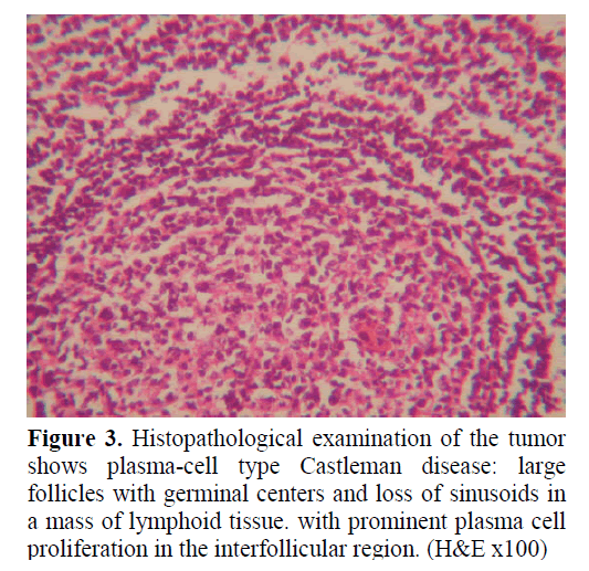 pancreas-histopathological-examination