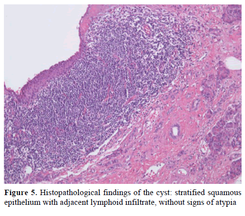 pancreas-histopathological-findings