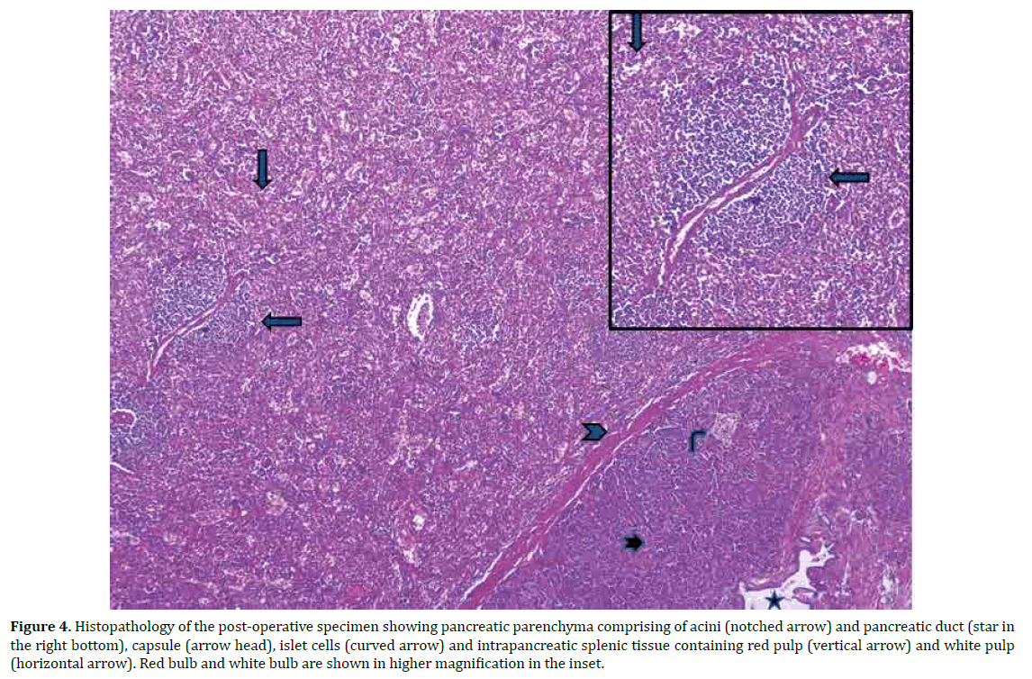 pancreas-histopathology