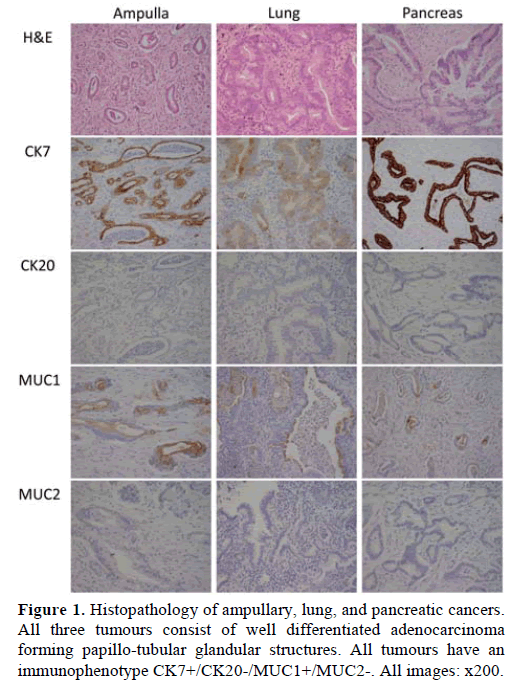 pancreas-histopathology-ampullary-lung