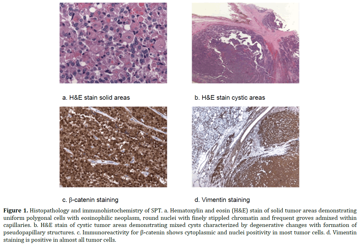 pancreas-histopathology-immunohistochemistry