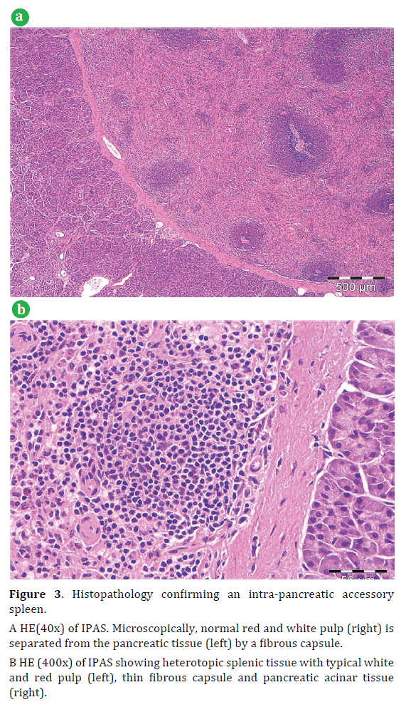 pancreas-histopathology-intra-pancreatic