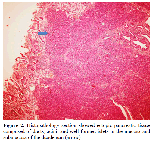 pancreas-histopathology-section-pancreatic