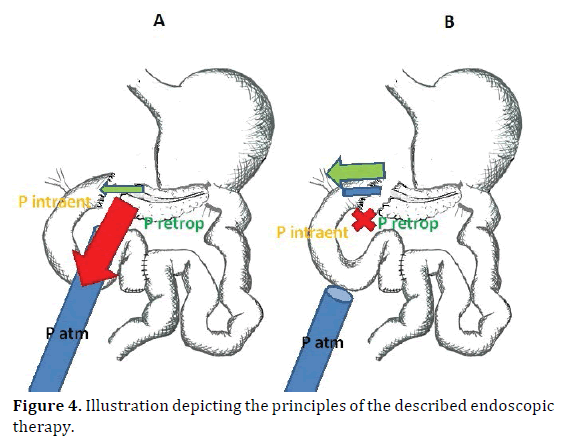 pancreas-illustration-therapy