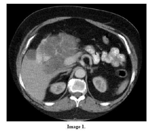 pancreas-image