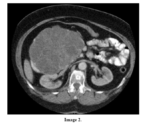 pancreas-image