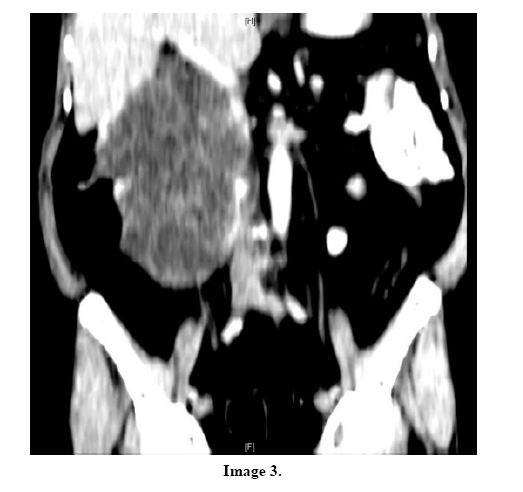 pancreas-image