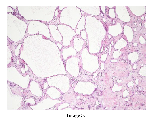 pancreas-image