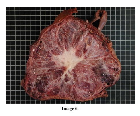 pancreas-image