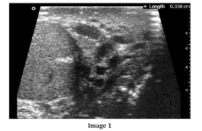 pancreas-image