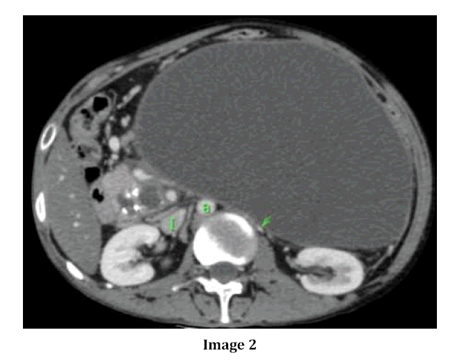 pancreas-image