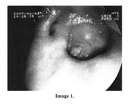 pancreas-image