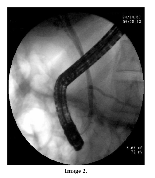 pancreas-image