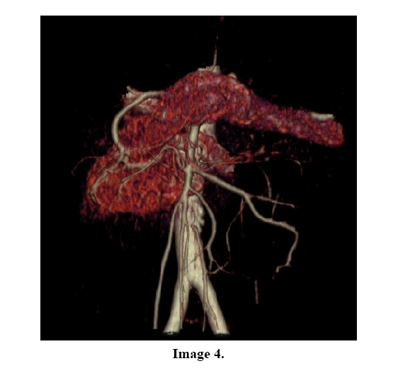 pancreas-image