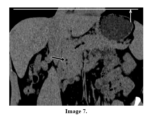 pancreas-image