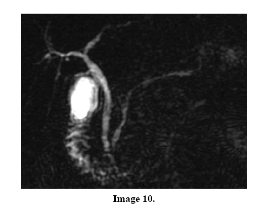 pancreas-image