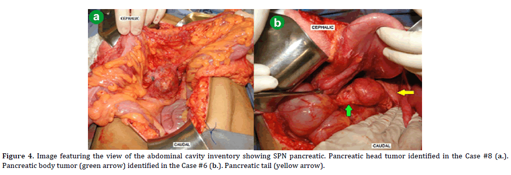 pancreas-image-featuring-abdominal