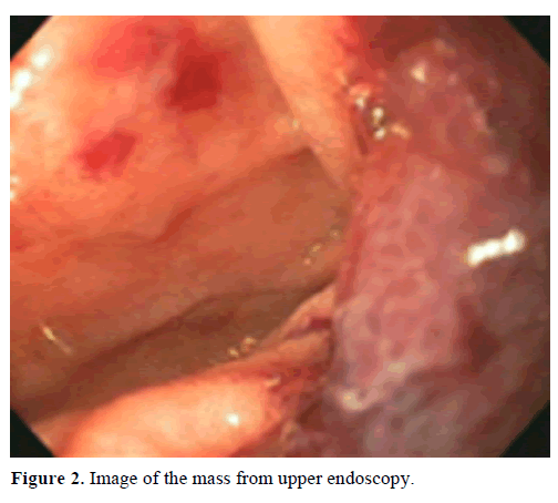 pancreas-image-mass-endoscopy