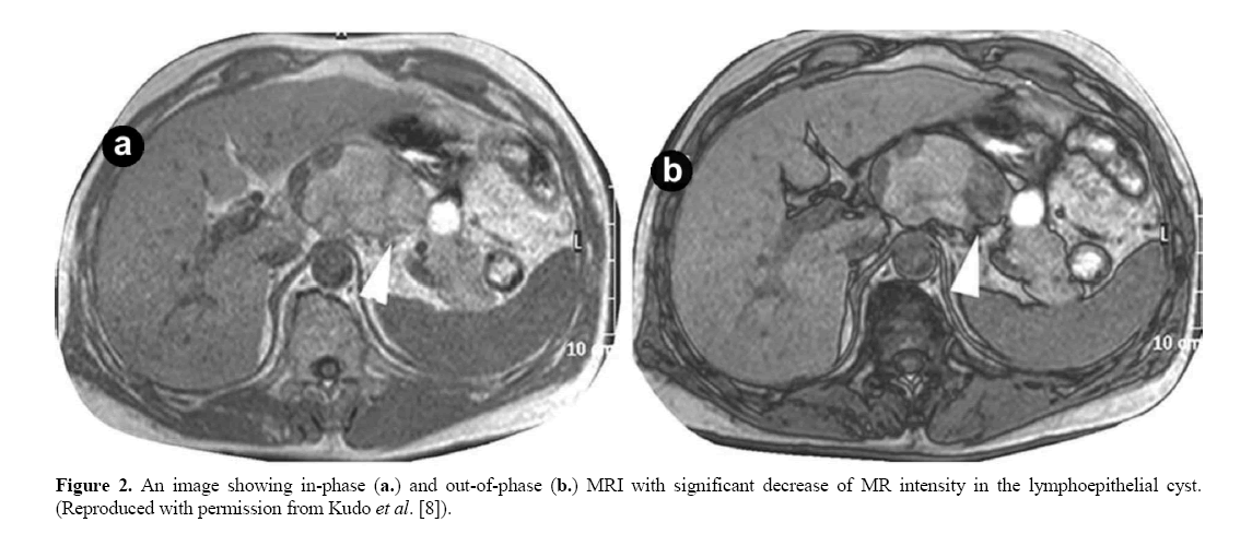 pancreas-image-showing-in-phase