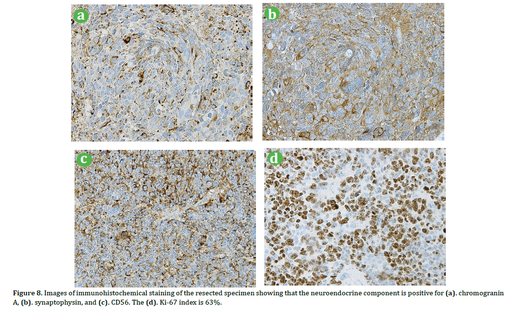 pancreas-images-immunohistochemical