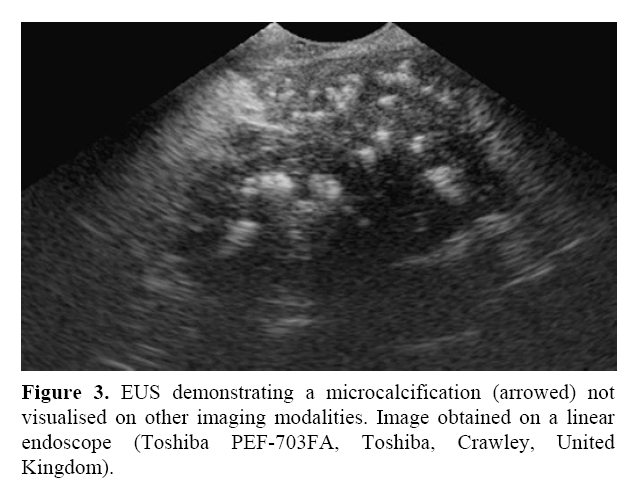 pancreas-imaging-modalities