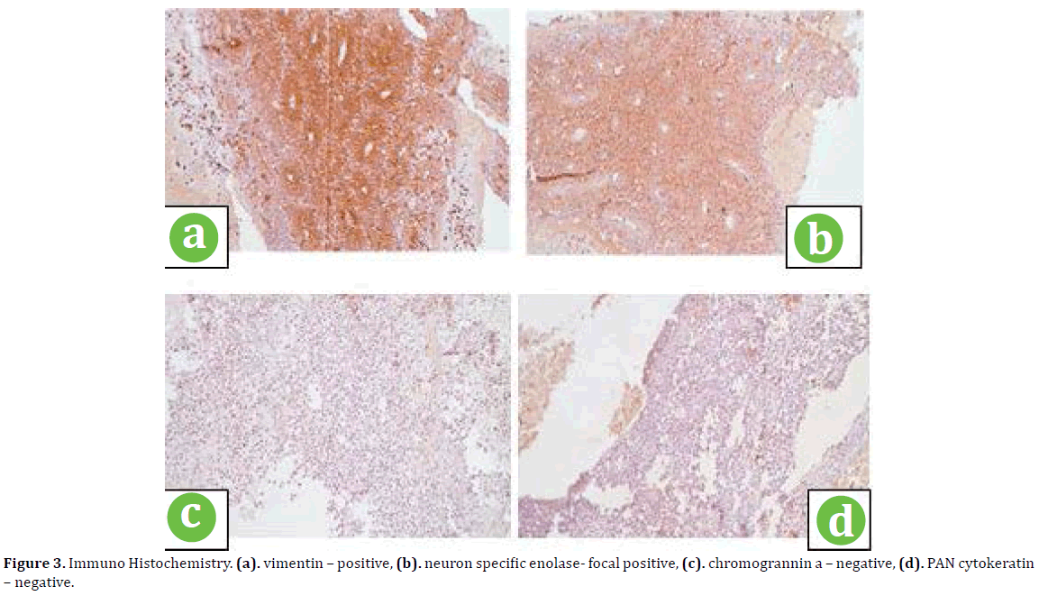 pancreas-immuno-histochemistry