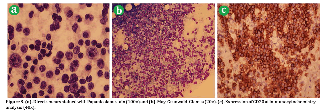 pancreas-immunocytochemistry