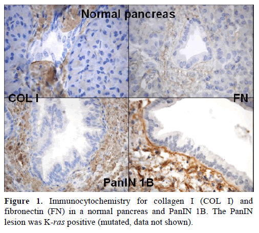 pancreas-immunocytochemistry-collagen