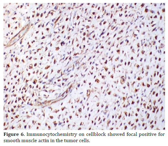 pancreas-immunocytochemistry-muscle-actin