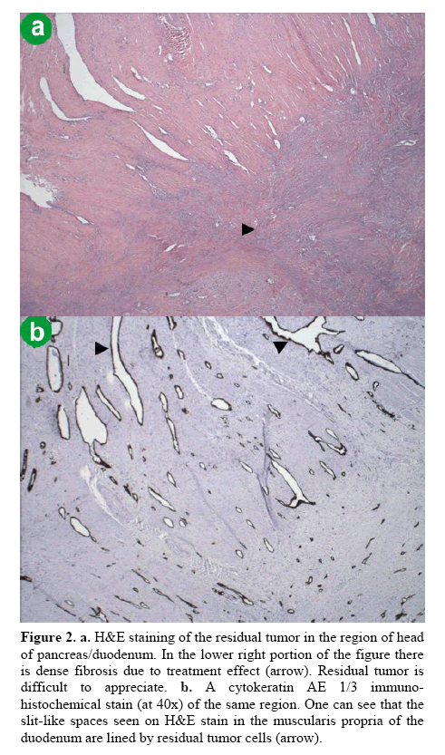 pancreas-immunohistochemical