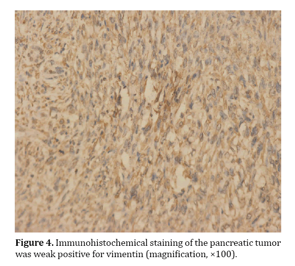 pancreas-immunohistochemical