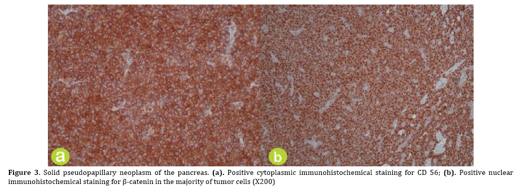 pancreas-immunohistochemical
