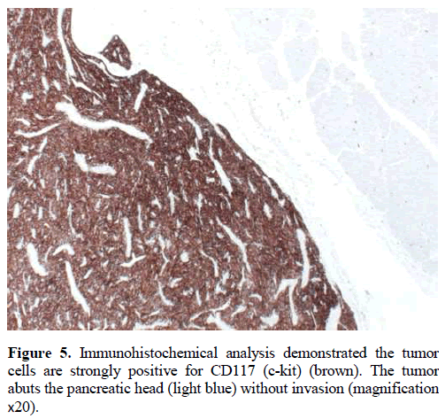 pancreas-immunohistochemical-analysis