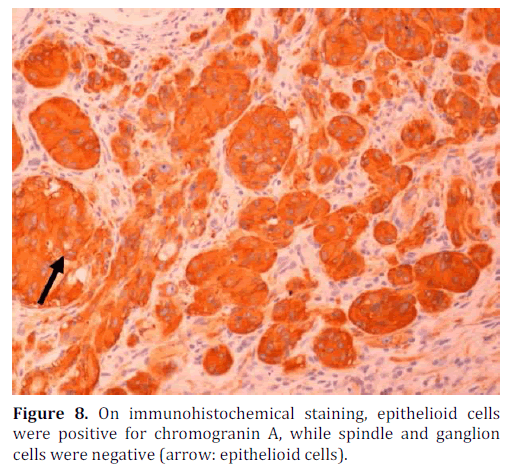 pancreas-immunohistochemical-epithelioid-cells