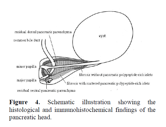 pancreas-immunohistochemical-findings