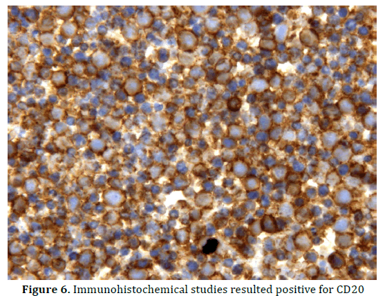 pancreas-immunohistochemical-positive