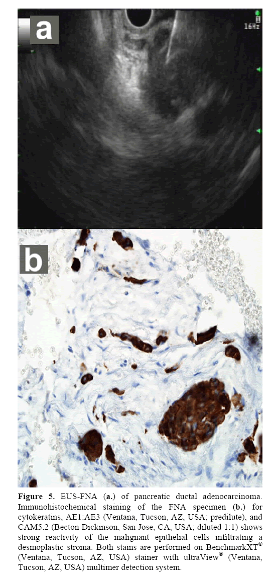 pancreas-immunohistochemical-staining