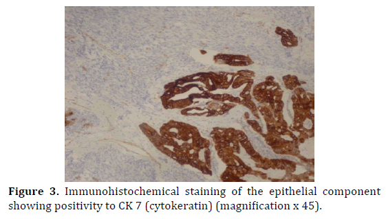 pancreas-immunohistochemical-staining